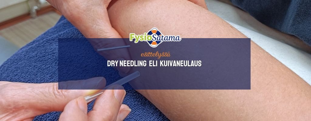 Dry Needling eli kuivaneulaus hieronnan lisäpalveluna